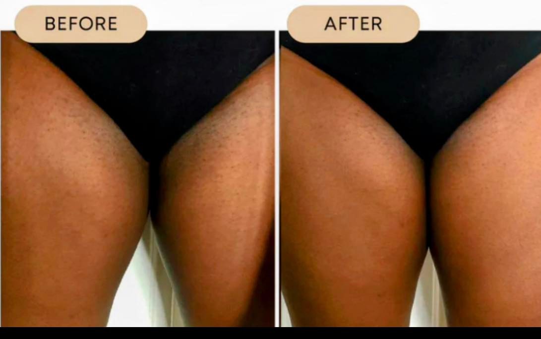 Bush Balm Dark Spot Oil