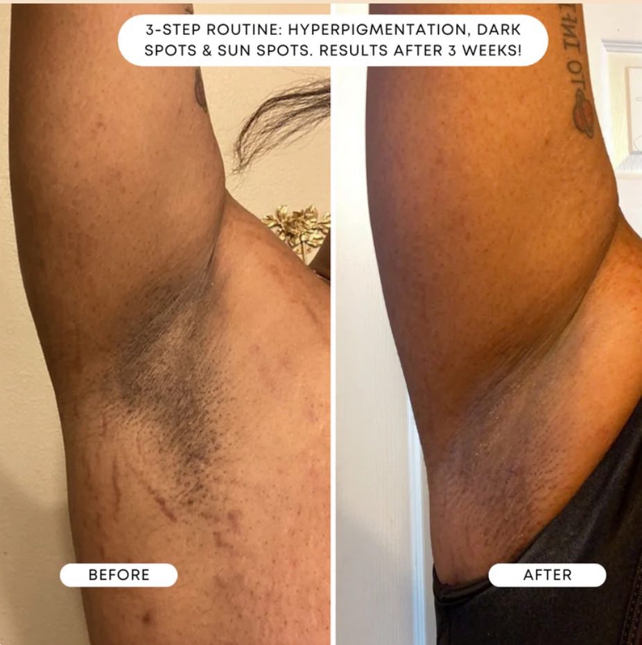 Bush Balm Dark Spot Exfoliant